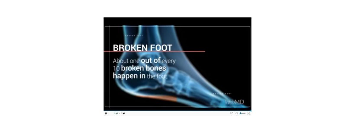 Safe Site – What Is Metatarsal protection?