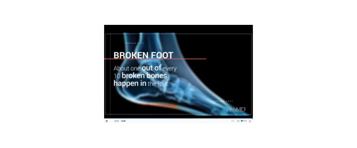 Safe Site – What Is Metatarsal protection?