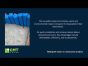 Introducing the TecDura Inflatable Stop End - Available at CMT
